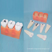 Human Dental Care Teeth Anatomy Model for Teaching (R080117)